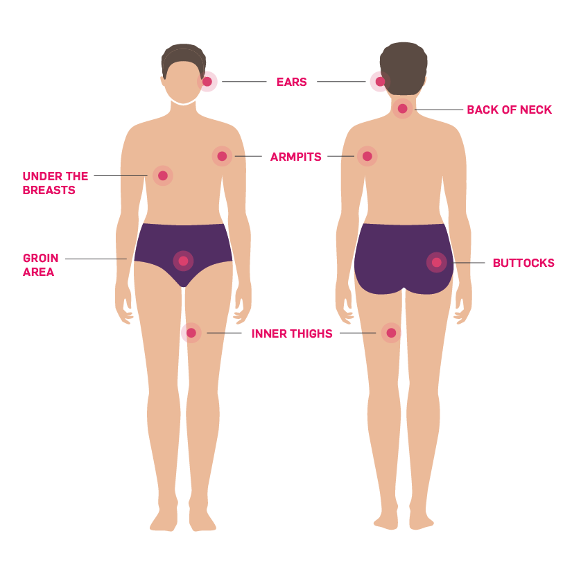 Image showing areas of body where HS commonly appears, including the armpits, groin area, inner thighs, buttocks, under the breasts, back of neck, and ears.