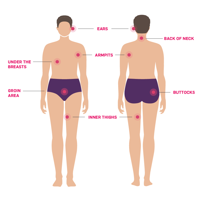 Image showing areas of body where HS commonly appears including the armpits, groin area, inner thighs, buttocks, under the breasts, back of the neck and ears.