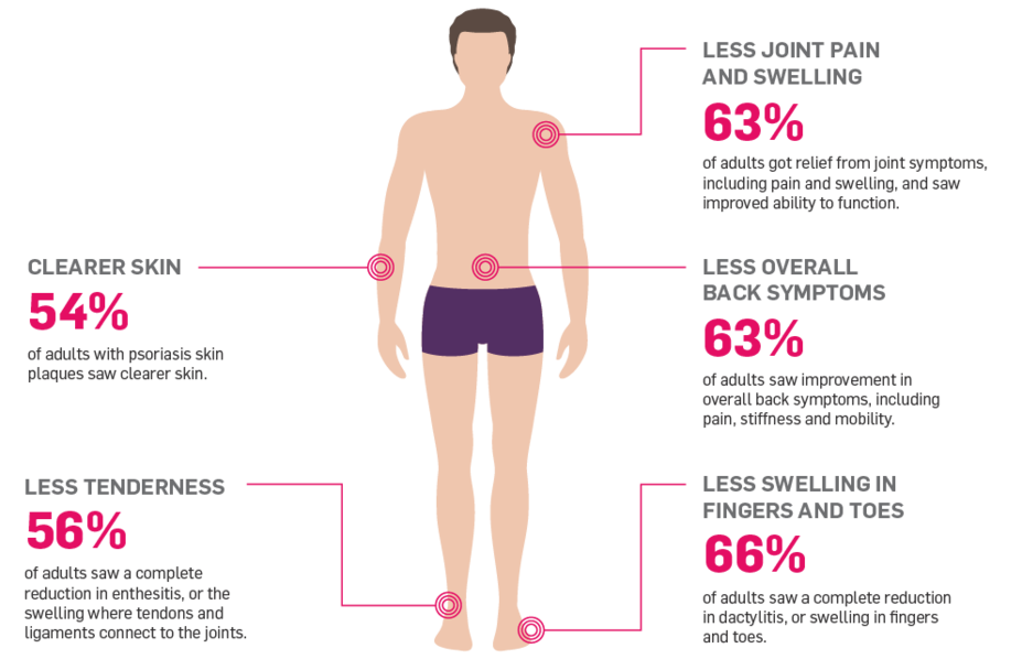 Infographic showing Cosentyx targeting more than joint pain. Cosentyx treats the multiple symptoms of Psoriatic arthritis (PsA).