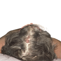 Scalp image