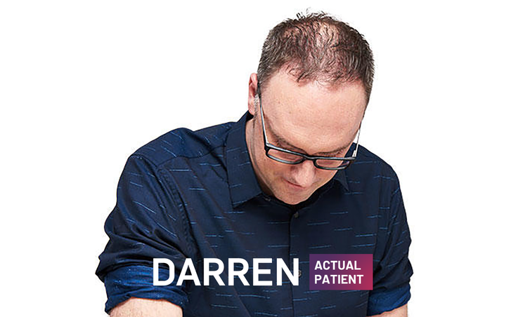COSENTYX psoriasis patient Darren scalp