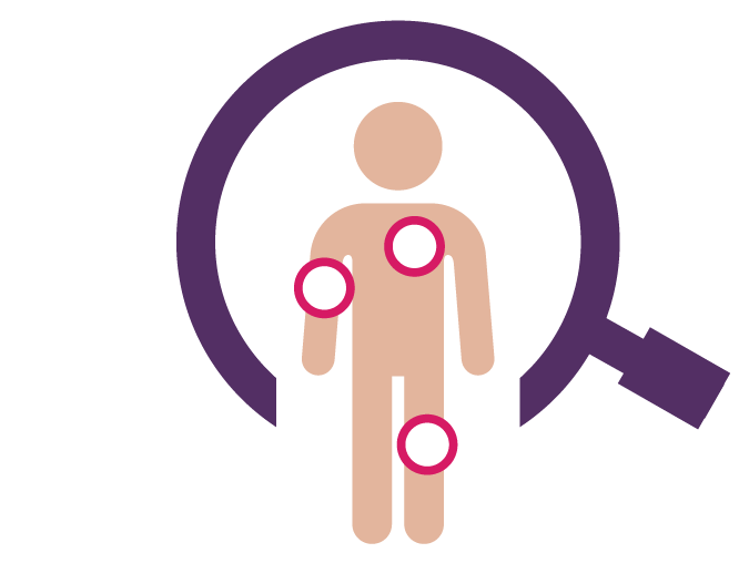 Graphic of magnifying glass, human and diagnostic points for non-radiographic axial spondyloarthritis.